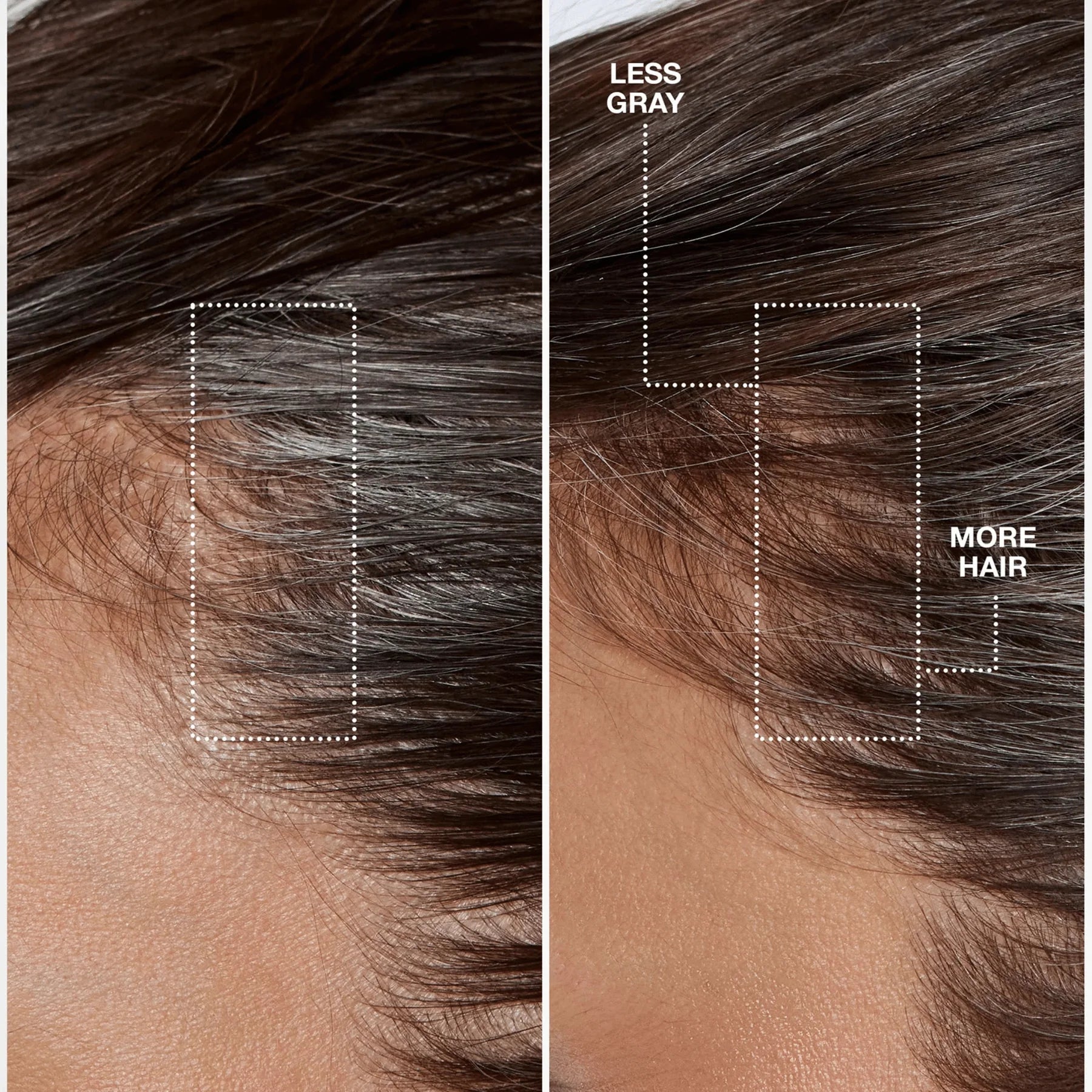 K18. SÉRUM BIOMIMÉTIQUE LONGÉVITÉ CAPILLAIRE FUTURE IQ - 90 ML