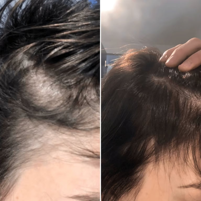 L'ORÉAL. SÉRIE EXPERT SÉRUM DENSIFIANT SERIOXYL ADVANCED - 90 ML